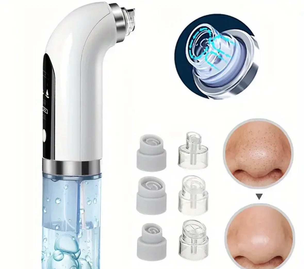 Blackhead Remover