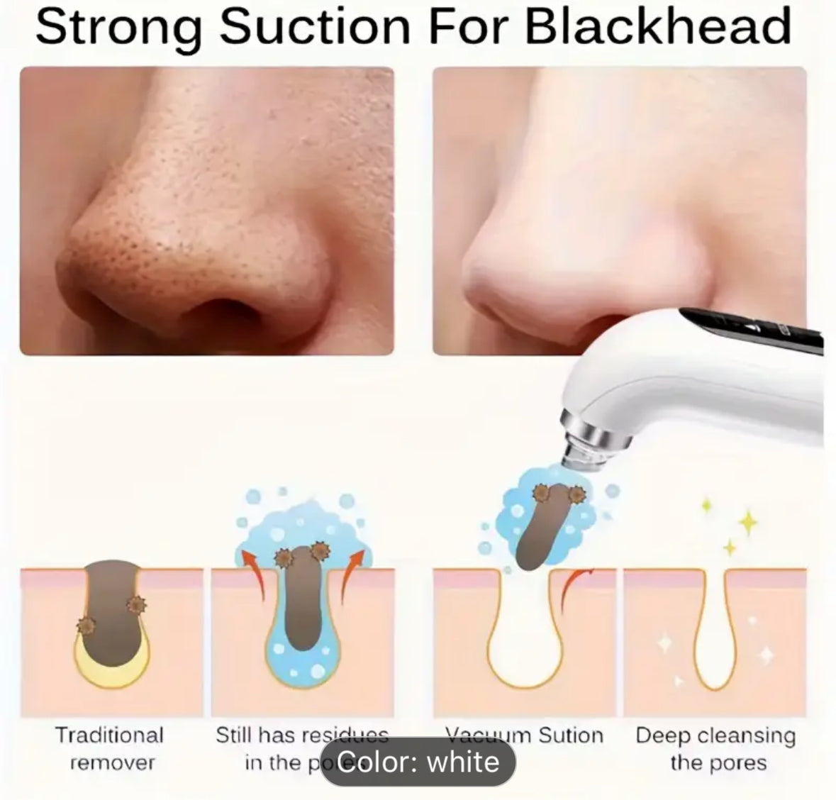 Blackhead Remover